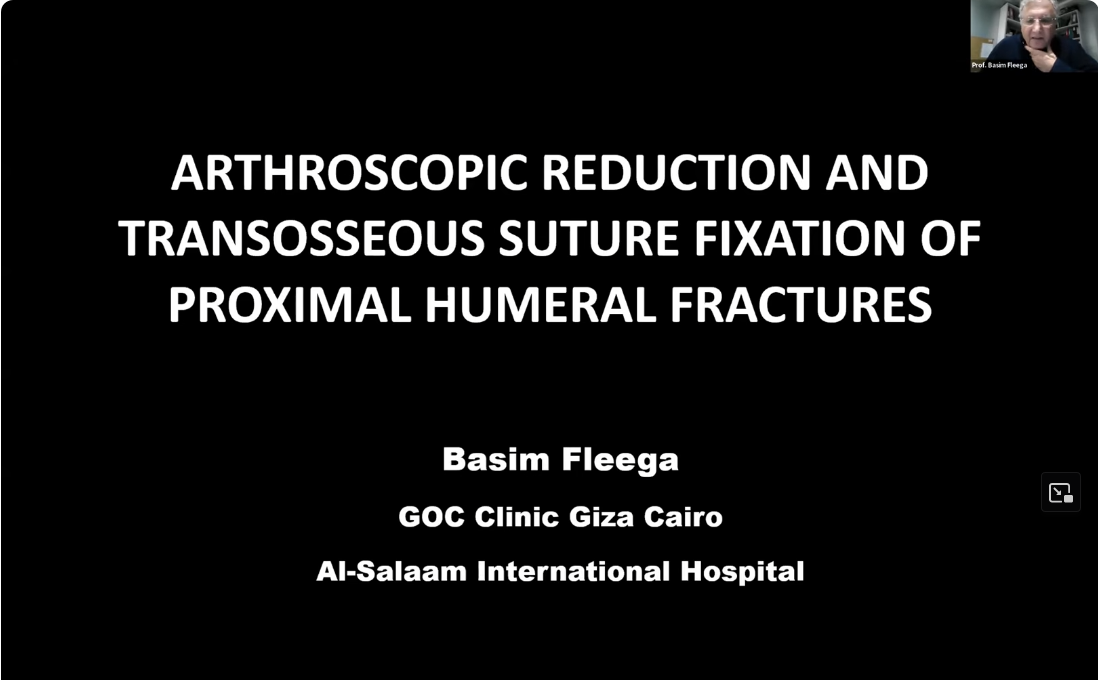 Screenshot-2023-12-03-at-15-02-13-Arthroscopic-Reduction-and-Transcosseous-Suture-Fixation-of-Proximal-Humeral-Fractures-October-2023-YouTube.png